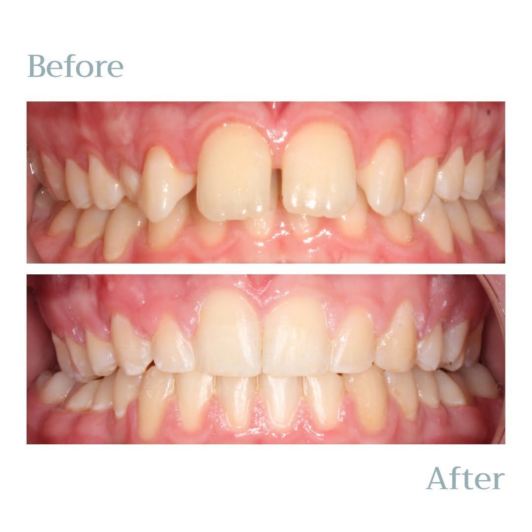 Solas orthodontics