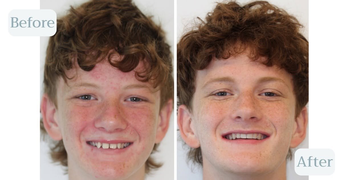 Solas orthodontics