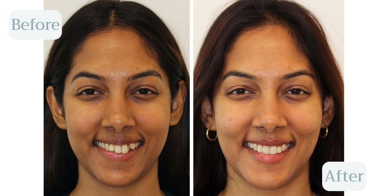 Solas orthodontics