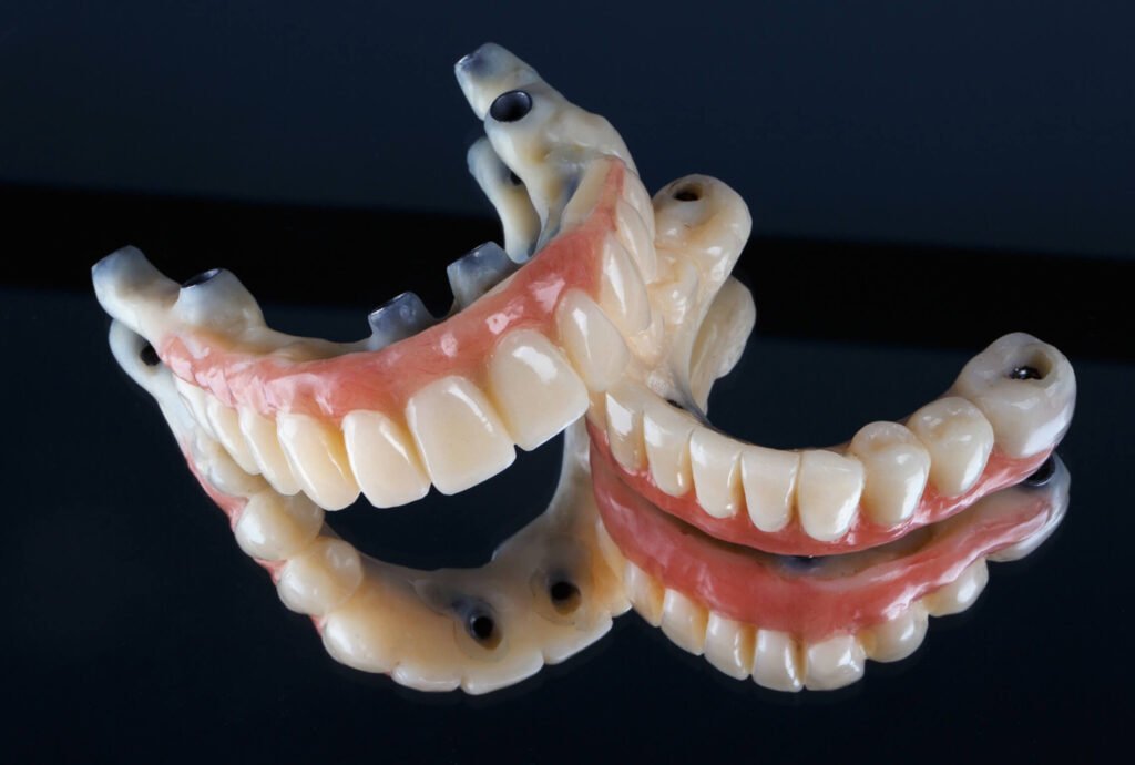 Dental Bridges Mathoura